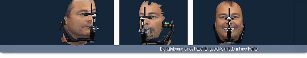 Citydental-Labor PRETTAU® ZIRKON