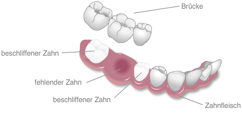 Citydental-Labor - Festsitzender Zahnersatz