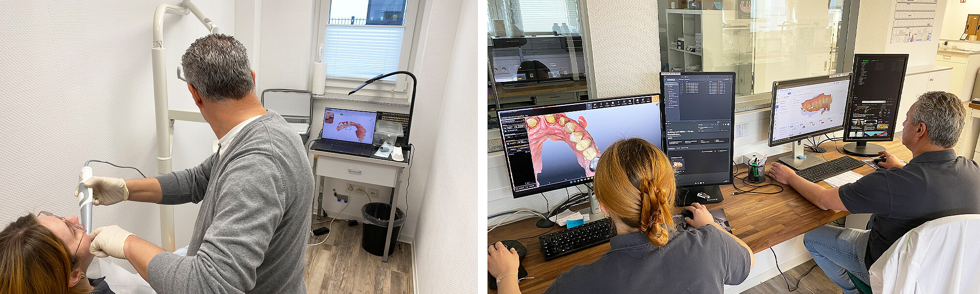 Kombination aus Intraoralscan am Patienten und digitaler CAD/CAM-Planung im Dentallabor