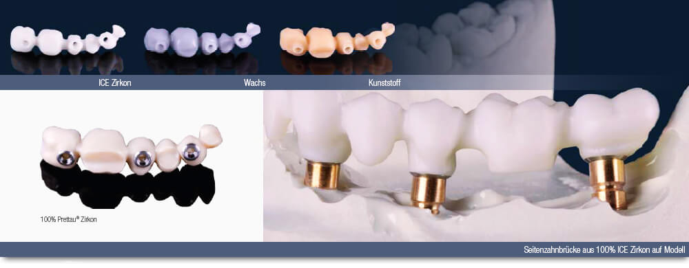 Citydental-Labor PRETTAU® ZIRKON