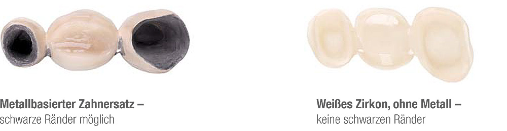 Citydental-Labor PRETTAU® ZIRKON