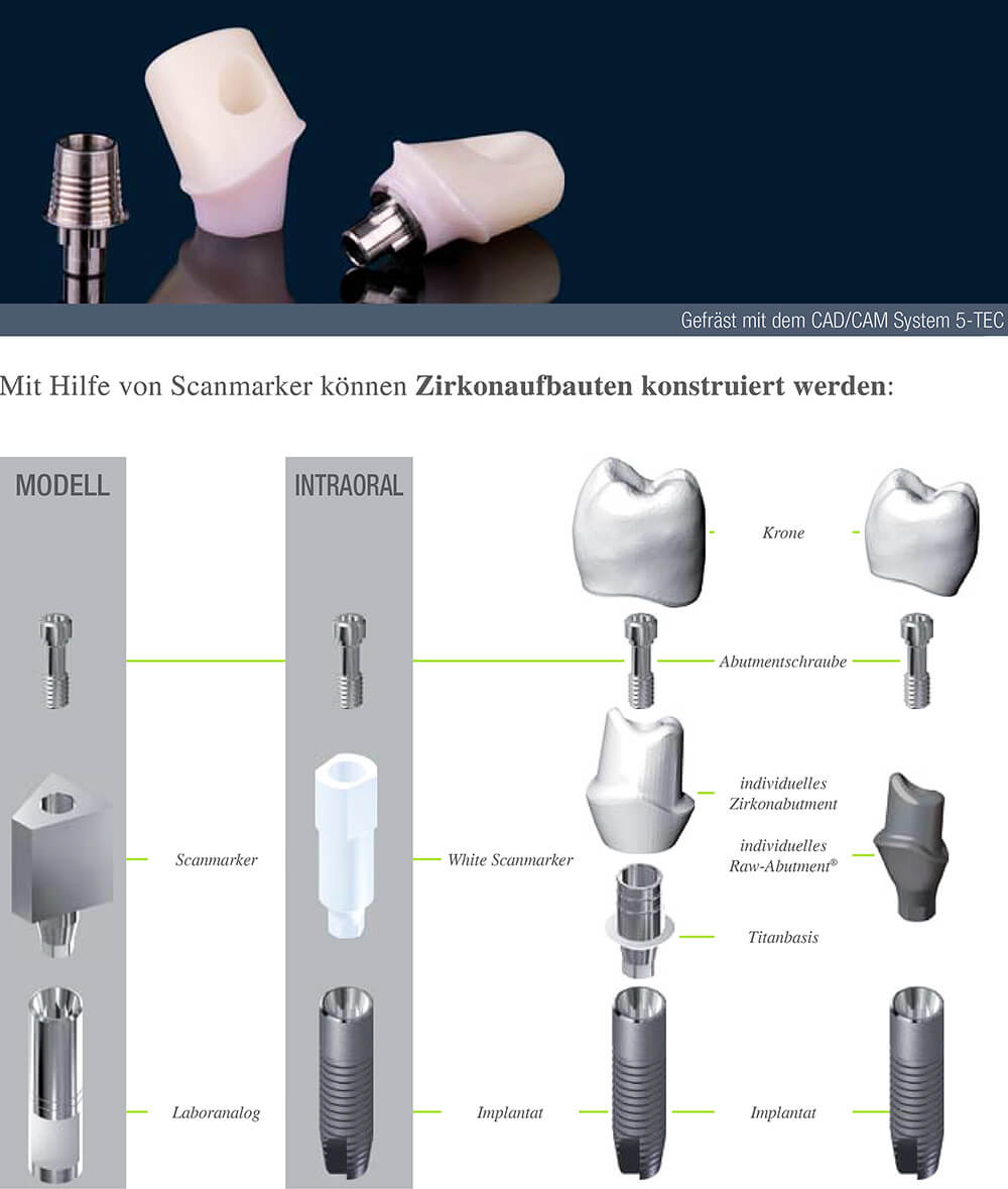 Citydental-Labor PRETTAU® ZIRKON