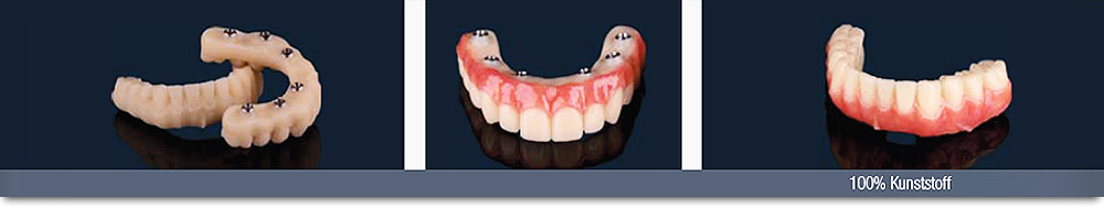 Citydental-Labor PRETTAU® ZIRKON