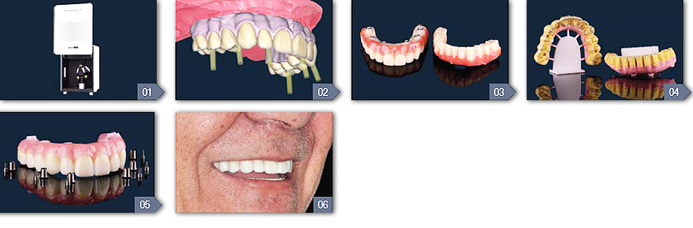 Citydental-Labor PRETTAU® ZIRKON
